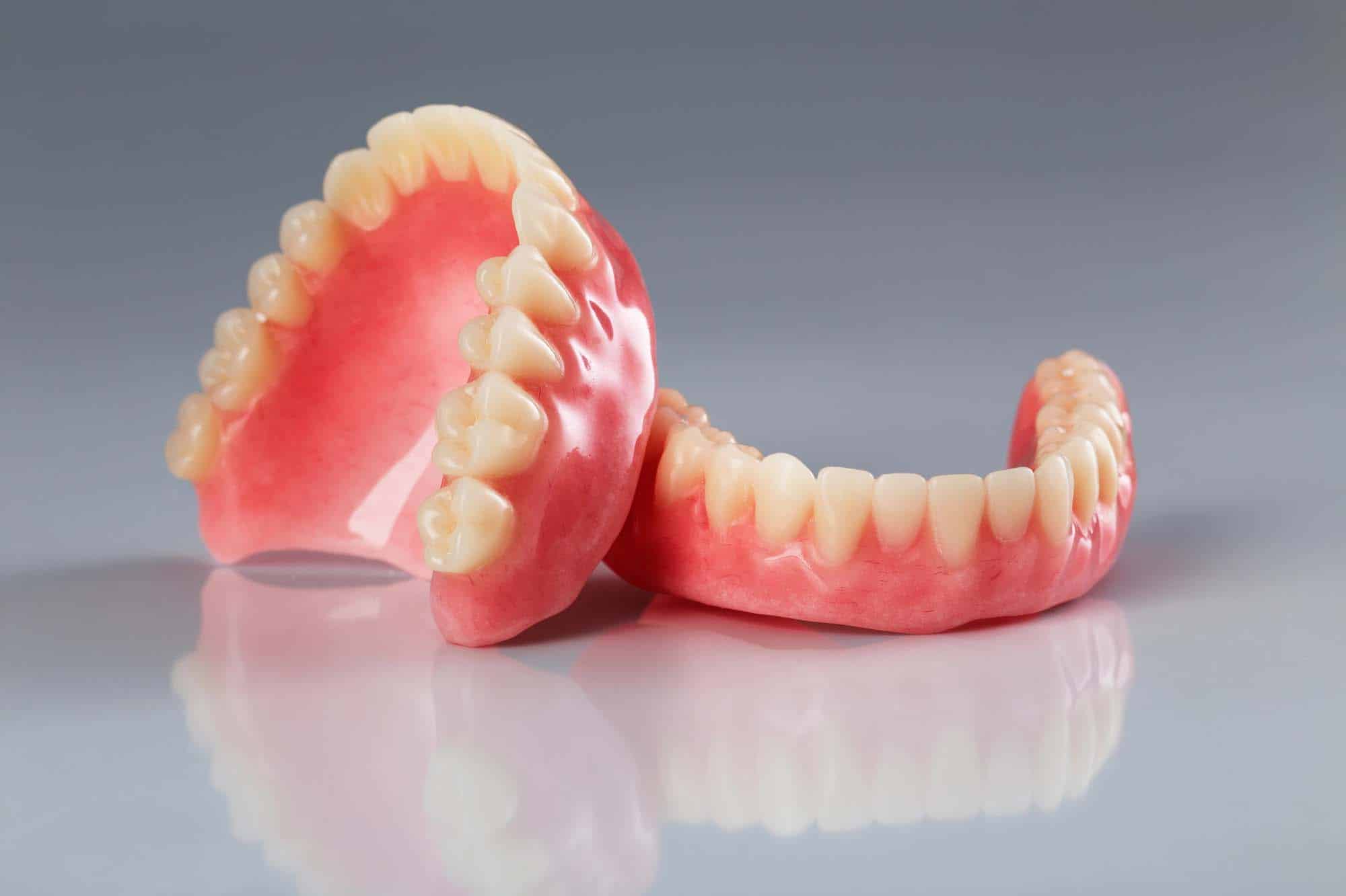 Dentures as an Alternative to Implants